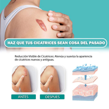 ¡RECUPERA TU CONFIANZA Y LUCE TU PIEL CON ORGULLO!